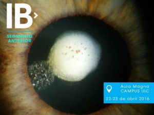 curso sobre cirugía de la catarata