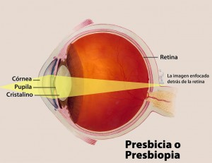 presbicia-vista-cansada